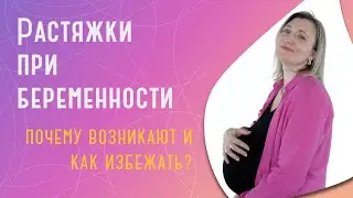 Растяжки при беременности: почему возникают и как избежать?