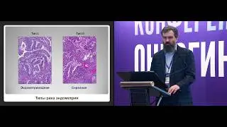 ИГХ диагностика редких гинекологических опухолей