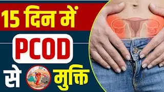 PCOD से बचने के Natural Tips  | Best Tips To Cure PCOD | Bharat Homeopathy