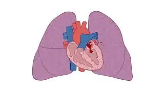 Blood Flow