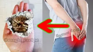 ضع الثوم في الألومينيوم أقسم بالله تعالج البواسير بدون جراحة