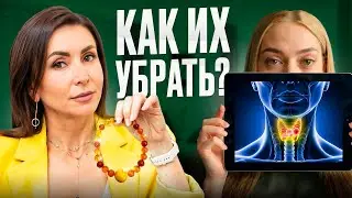 Как УМЕНЬШИТЬ узлы в щитовидной железе с помощью народных средств?