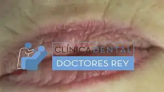 DENTISTA ESPECIALISTA INTEGRAL LÁSER PERIODONCIA E IMPLANTES VALLADOLID CLINICA DENTAL DOCTORES REY