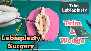 ✅ Labiaplasty Surgery | Techniques Türkiye - Funda Yazıcı Erol MD