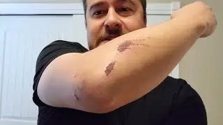 Personal Update - Motorcycle Accident