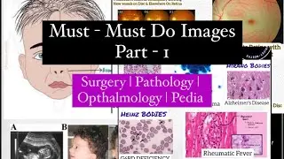 Most important Images Part 1 Neetpg | Inicet | Fmge || Mis.Medicine