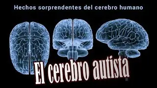 Los cerebros de niños con autismo