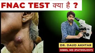 FNAC TEST (HINDI) कैसे इस टेस्ट से टीबी से लेकर कैंसर तक का पता चलता है ?