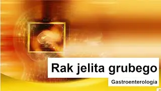 Rak jelita grubego - objawy, rokowania, leczenie