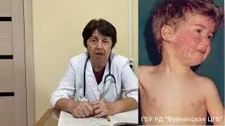 Все что нужно знать о коревой инфекции. Т.Шамиловна, врач инфекционист-реаниматолог БЦГБ.