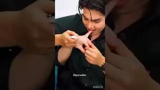 He bite his finger 🤞