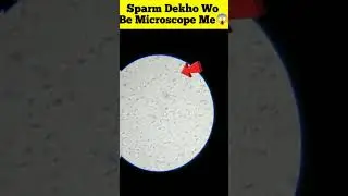 human semen test in microscope !! sperm😱 #shorts #microscope #sperm