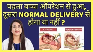 पहला बच्चा ऑपरेशन से हुआ, दूसरा NORMAL DELIVERY से होगा या नहीं ? NORMAL DELIVERY AFTER C-SECTION