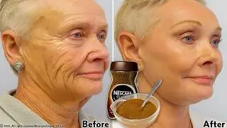 ☕ Coffee is a million times more powerful than Botox / Collagen to remove wrinkles and fine lines 🔥