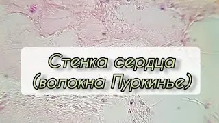 Heart wall (Purkinje fibers)