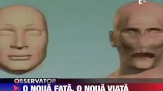 Primul transplant total de fata din SUA 22 MARTIE 2011