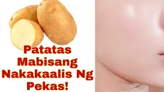 Patatas Mabilis Makaalis Ng Mga Pekas/Dark Spots At Nakakaputi Pa!😮😮😮