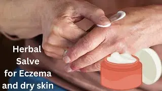 Healing Salve for Eczema and very dry skin