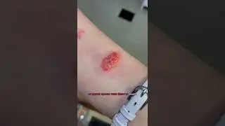 🚨АЛЛЕРГИЯ НА КРАСКУ ДЛЯ БРОВЕЙ 
