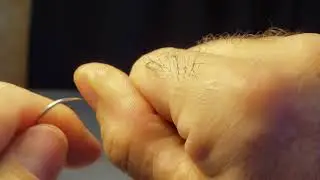 Great way to remove a splinter. Remove small wood splinter
