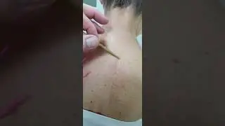 Индивидуальный поиск лечебных точек.