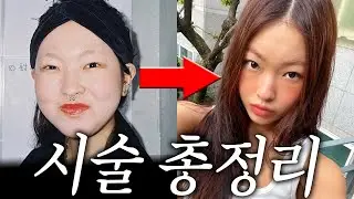 내가 예뻐진 이유...🧐 지금까지 했던 시술후기 및 관리 대.공.개🔥 (지방분해주사, 인모드, 보톡스 등등)