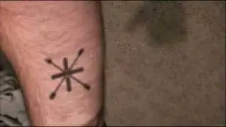 Disappearing Tattoo