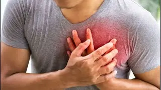 Chest Pain | How does heart attack present? | Heart Attack Ki Kiya Presentation Hoti Ha