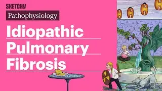 Idiopathic Pulmonary Fibrosis (Pathophysiology) | Sketchy Medical