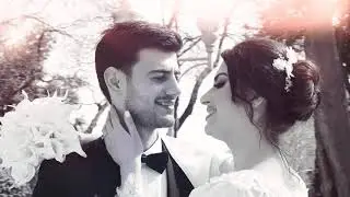 İradə Mehri — O Da Sənsən (Teaser)