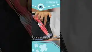 手指出現痠麻痛可能患上旋前圓肌綜合症｜醫SICK醫識  