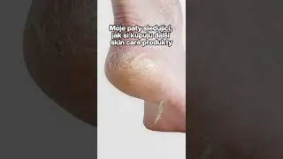 Milion skincare produktů a na paty nic 💀