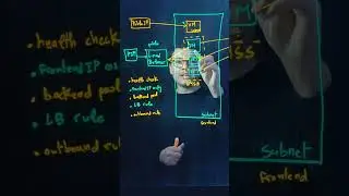 Why Azure Load Balancer