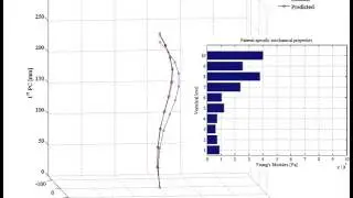 Assessment of patient-specific spine mechanical properties