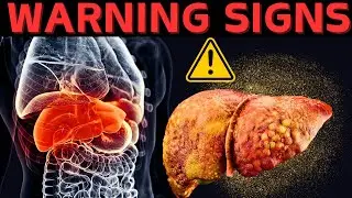 LIVER DYING ALERT : ⚠️12 Weird Signs of LIVER DAMAGE.⚠️