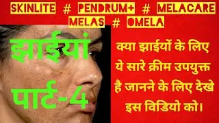 झाईयां फिर से वापस क्यों आ जाती है || Pigmentation || Jhaiya || Melasma