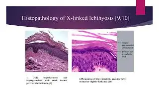 Heriditary skin diseases  Part 1