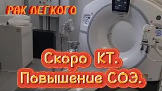 #68 РАК ЛЕГКОГО. Скоро КТ. Повышение СОЭ.