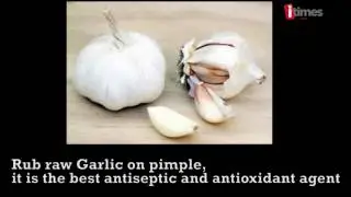 Home Remedies To Get Rid Of Pimples
