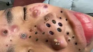 تلميع وتنظيف الجلد الطبيعي المدور 1413559
