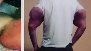 Russian bodybuilder warned his ‘Popeye’ arms might be AMPUTATED
