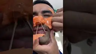 Удаление лишних волос воском с лица и нос❗️❗️