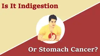 The WARNING SIGNS that your INDIGESTION symptoms could be STOMACH CANCER
