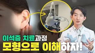 이석증 치료! 모형으로 이해하기 쉽게 설명 드릴게요