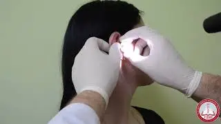 Otoscopy