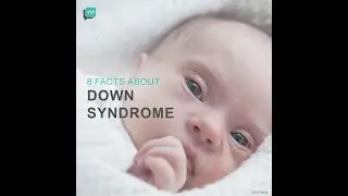 8 Facts About Down Syndrome