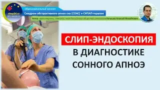#12.1: Слип-эндоскопия в диагностике сонного апноэ | СОАС и СИПАП-терапия