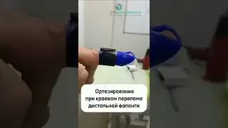 👉 Ортезирование при краевом переломе дистальной фаланги