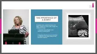Medical Oncologist Dr Michelle White - Metastatic Breast Cancer - Mission Beach Information Forum