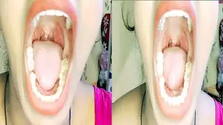 Open Mouth Zoom Camera Challenge 👄 Tongue 👅 Dancing Challengevideo @sumidas134